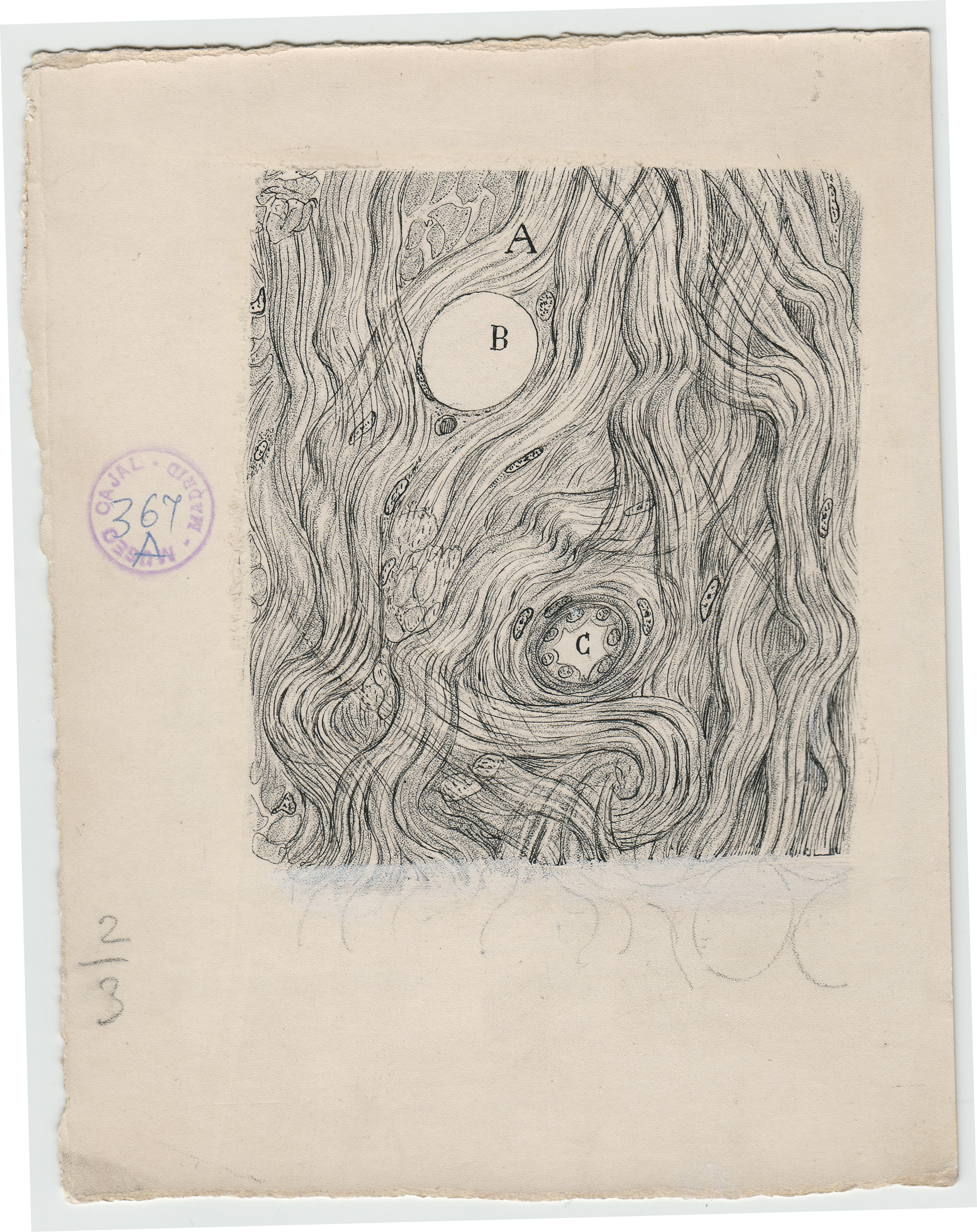 WAM_Cajal_m367a Santiago Ramón y Cajal, endotelioma de la duramadre, 1890, ink and pencil on paper. Courtesy of Instituto Cajal (CSIC).